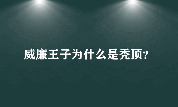 威廉王子为什么是秃顶？