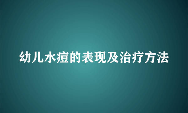 幼儿水痘的表现及治疗方法