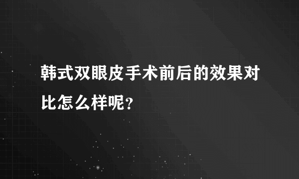 韩式双眼皮手术前后的效果对比怎么样呢？