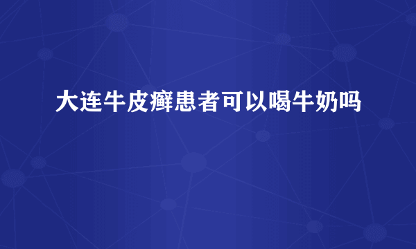 大连牛皮癣患者可以喝牛奶吗