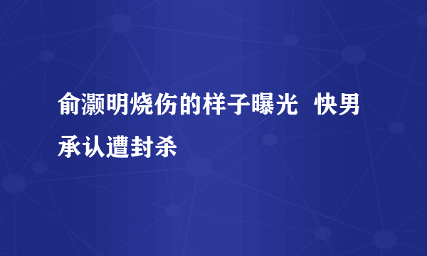 俞灏明烧伤的样子曝光  快男承认遭封杀