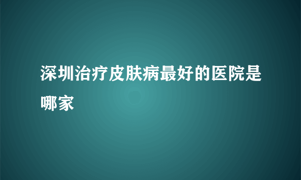 深圳治疗皮肤病最好的医院是哪家