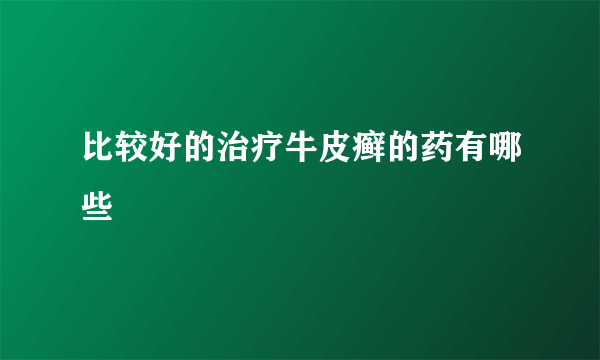 比较好的治疗牛皮癣的药有哪些