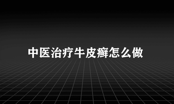 中医治疗牛皮癣怎么做 