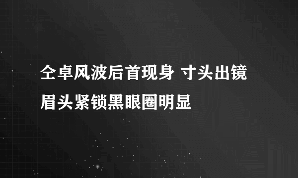 仝卓风波后首现身 寸头出镜眉头紧锁黑眼圈明显