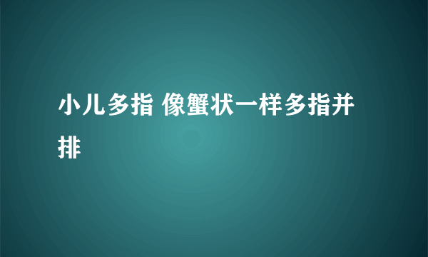 小儿多指 像蟹状一样多指并排