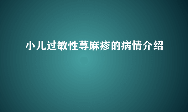 小儿过敏性荨麻疹的病情介绍