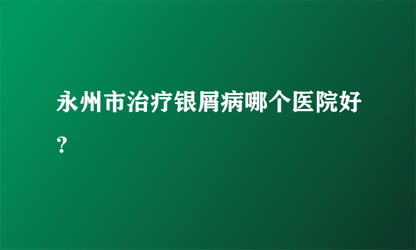 永州市治疗银屑病哪个医院好？