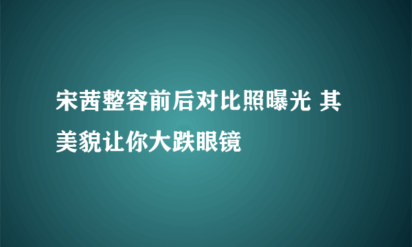 宋茜整容前后对比照曝光 其美貌让你大跌眼镜