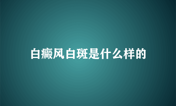 白癜风白斑是什么样的