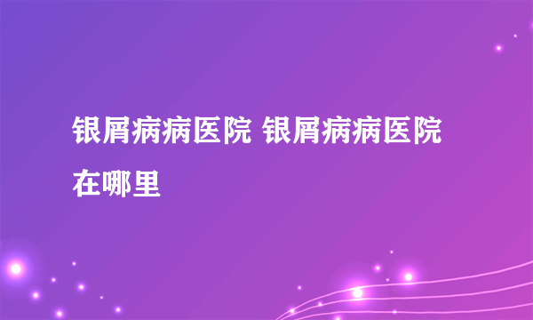 银屑病病医院 银屑病病医院在哪里