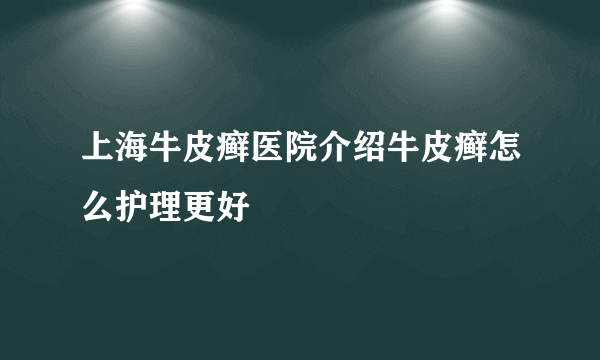 上海牛皮癣医院介绍牛皮癣怎么护理更好