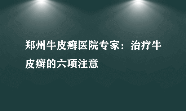 郑州牛皮癣医院专家：治疗牛皮癣的六项注意