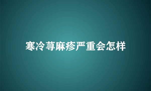 寒冷荨麻疹严重会怎样