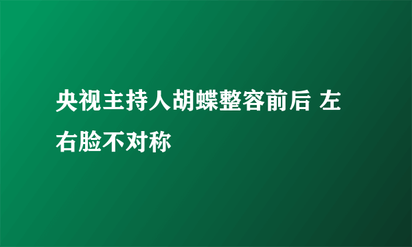 央视主持人胡蝶整容前后 左右脸不对称