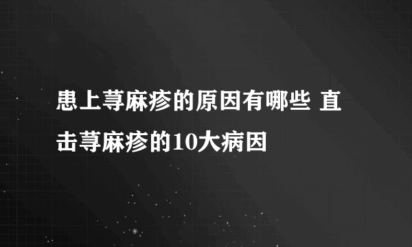 患上荨麻疹的原因有哪些 直击荨麻疹的10大病因