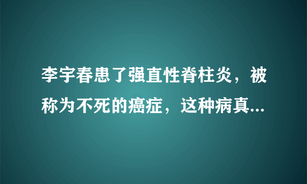 李宇春患了强直性脊柱炎，被称为不死的癌症，这种病真的很可怕吗？