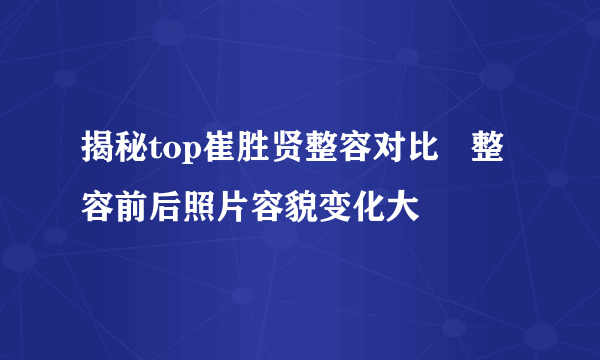 揭秘top崔胜贤整容对比   整容前后照片容貌变化大