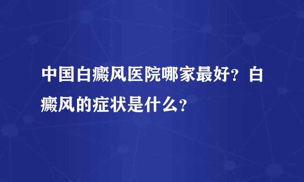 中国白癜风医院哪家最好？白癜风的症状是什么？