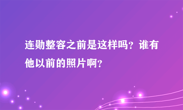 连勋整容之前是这样吗？谁有他以前的照片啊？