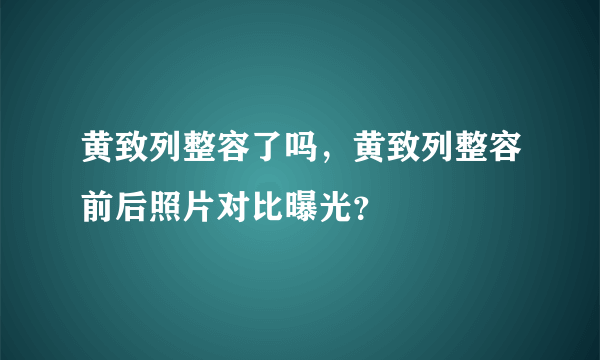 黄致列整容了吗，黄致列整容前后照片对比曝光？