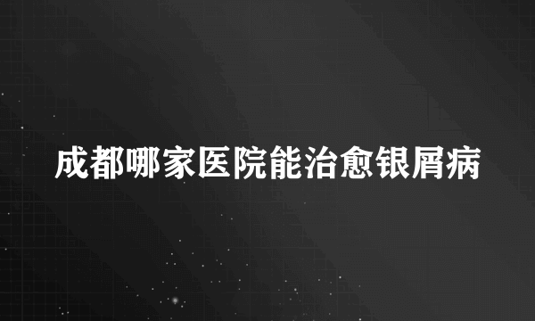 成都哪家医院能治愈银屑病