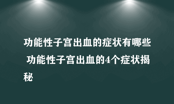 功能性子宫出血的症状有哪些 功能性子宫出血的4个症状揭秘