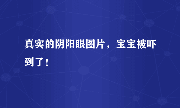 真实的阴阳眼图片，宝宝被吓到了！