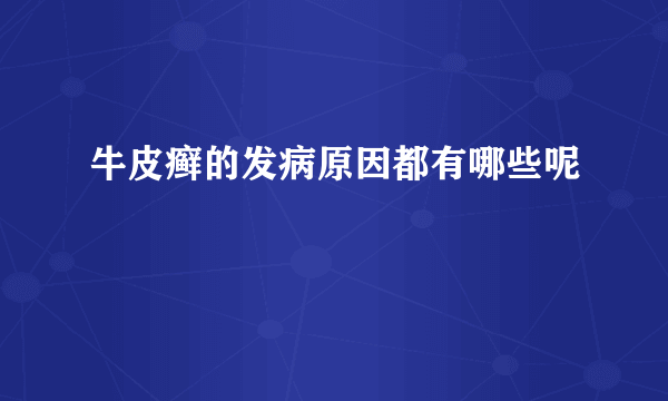 牛皮癣的发病原因都有哪些呢