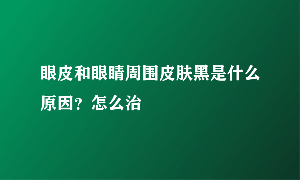 眼皮和眼睛周围皮肤黑是什么原因？怎么治