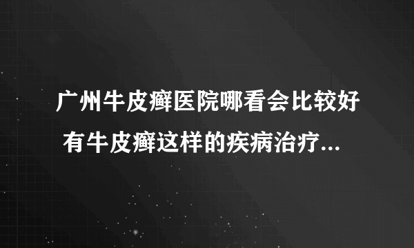 广州牛皮癣医院哪看会比较好 有牛皮癣这样的疾病治疗方法有什么呢