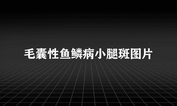 毛囊性鱼鳞病小腿斑图片