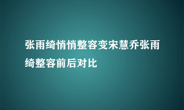 张雨绮悄悄整容变宋慧乔张雨绮整容前后对比