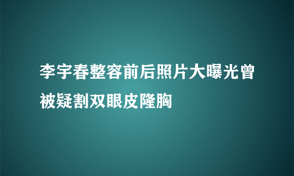 李宇春整容前后照片大曝光曾被疑割双眼皮隆胸