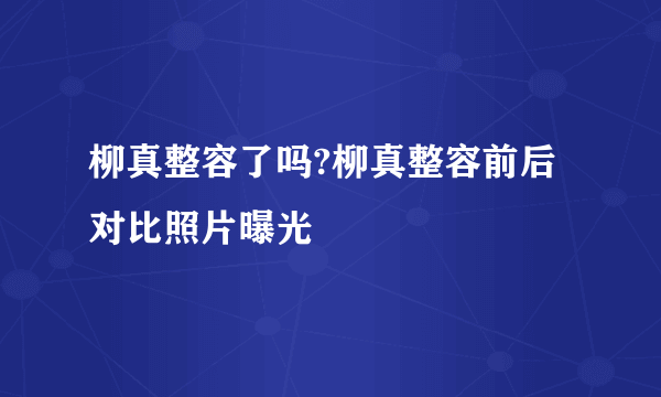 柳真整容了吗?柳真整容前后对比照片曝光