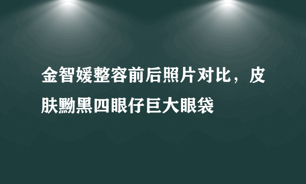 金智媛整容前后照片对比，皮肤黝黑四眼仔巨大眼袋 