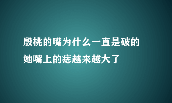 殷桃的嘴为什么一直是破的 她嘴上的痣越来越大了