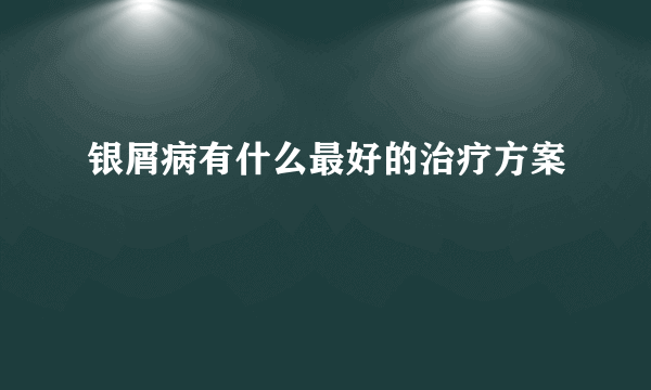 银屑病有什么最好的治疗方案