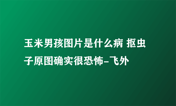 玉米男孩图片是什么病 抠虫子原图确实很恐怖-飞外