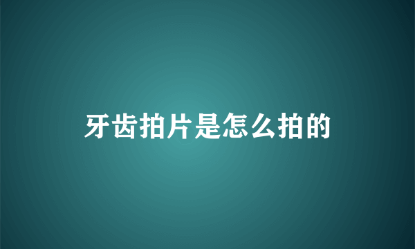 牙齿拍片是怎么拍的