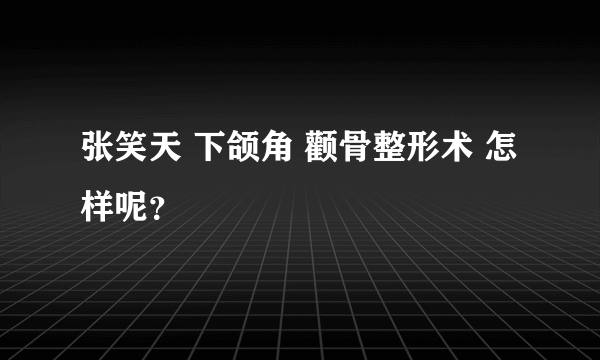 张笑天 下颌角 颧骨整形术 怎样呢？