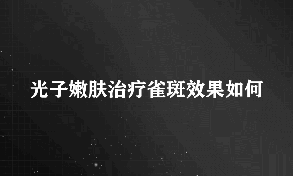 光子嫩肤治疗雀斑效果如何