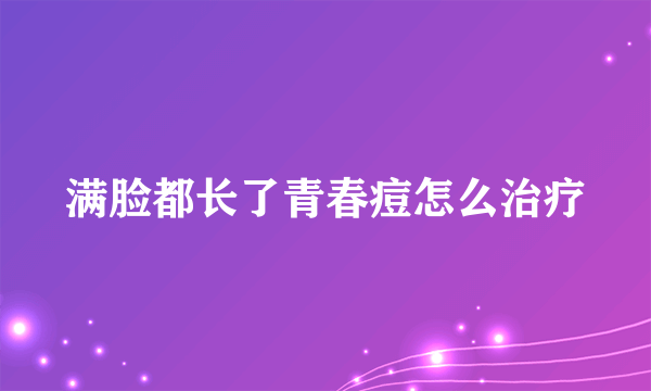 满脸都长了青春痘怎么治疗