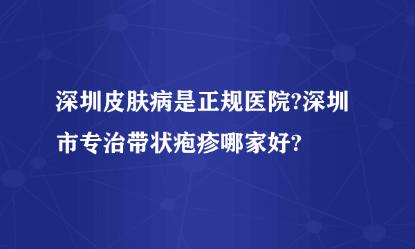 深圳皮肤病是正规医院?深圳市专治带状疱疹哪家好?