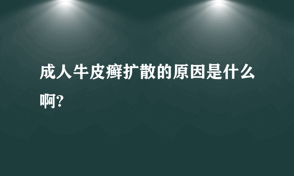 成人牛皮癣扩散的原因是什么啊?