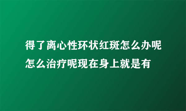 得了离心性环状红斑怎么办呢怎么治疗呢现在身上就是有