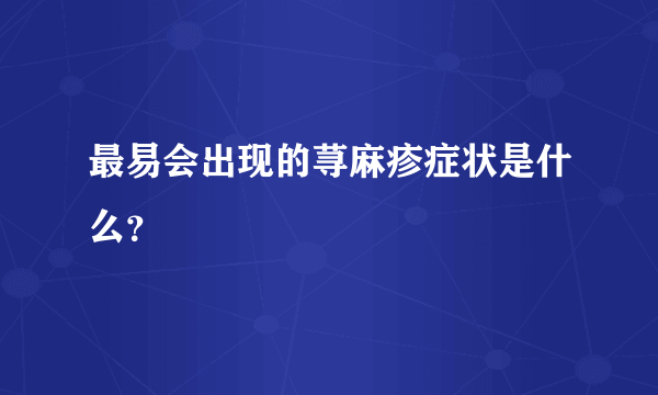 最易会出现的荨麻疹症状是什么？