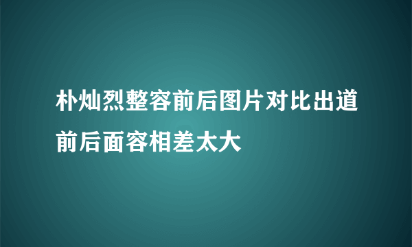 朴灿烈整容前后图片对比出道前后面容相差太大