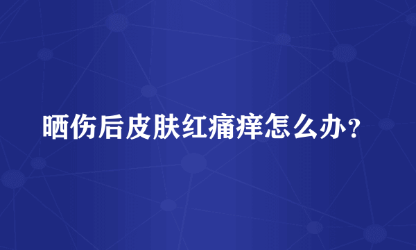 晒伤后皮肤红痛痒怎么办？