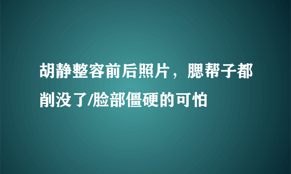 胡静整容前后照片，腮帮子都削没了/脸部僵硬的可怕 